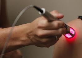 laser therapy chiropractic